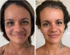 A mentira da recuperação rápida: Imagens falsas de Juliana Garcia